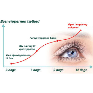 ØJENVIPPESERUM