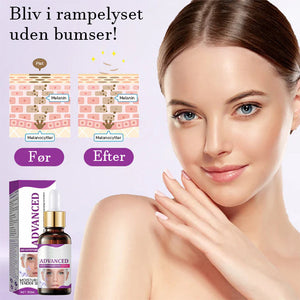Avanceret anti-pigmenteringsserum