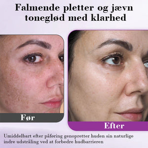 Avanceret anti-pigmenteringsserum